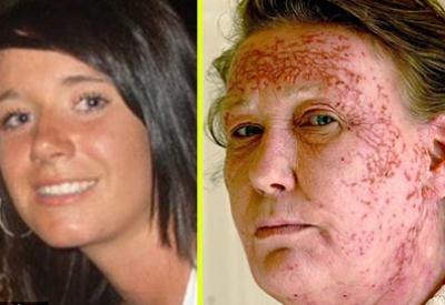 Saç boyaları böyle öldürüyor